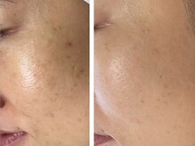 ポ ワール(Poir)/