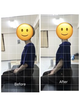 ナオル整体 センター南院(NAORU整体)/坐位姿勢のBefore After