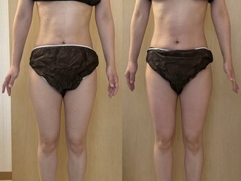 マイティー整骨院 ココア(CoCoa)/活性リンパ洗浄