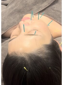 小顔になりたい