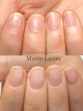 マリーロール 天王寺店(Marie Laure)/深爪矯正/自爪育成/ネイルケア/