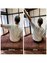ミントのかべの整体院/施術ビフォーアフター