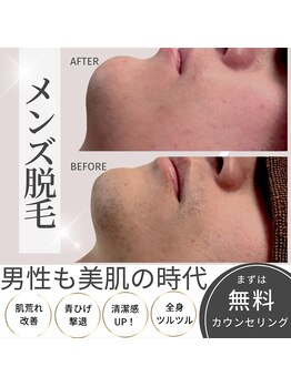 ラ ミュー エステハウス 松阪店/メンズ脱毛お試し