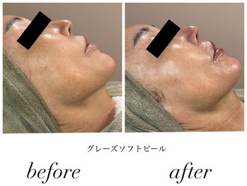 ビーエルティー(blt)/グレーズソフトピール