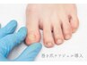 【巻き爪矯正ジェル】甘皮ケア付10本 ¥8,000