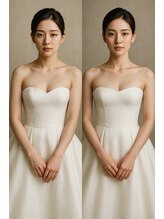 ラクリエ 姫路駅前院(La Creer)/姿勢【巻き肩/ブライダル】