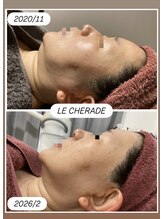 リシェラード/大人女子のためのシミケア