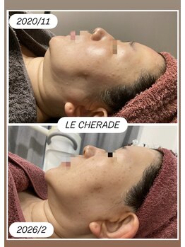 リシェラード/大人女子のためのシミケア