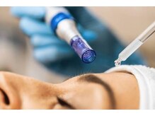 ドゥメール(DEMAILE)の雰囲気(毛穴の汚れ、角質一斉除去エステダーマで美容液をたっぷり注入)