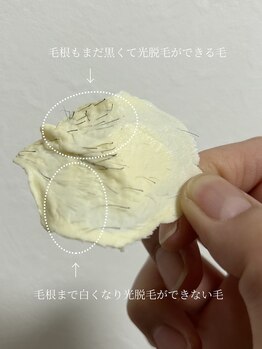 カナウ(KANAU)/VIO脱毛（60代男性）