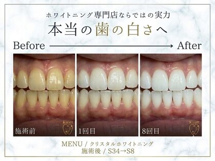 キラット 横浜店(Kiratt)の写真