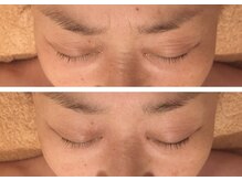 トリプルサンショップ 京都店/【幹細胞フェイシャル】