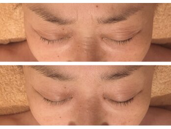 トリプルサンショップ 京都店/【幹細胞フェイシャル】