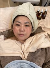 サナティオ(SANATIO)/オードリービューティーコース