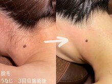 ルーナジェーナ(Luna llena)/