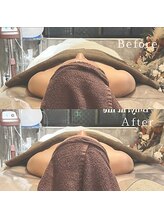 ブリリアントライフ(Blilyant life)/美zenフェイシャルTr