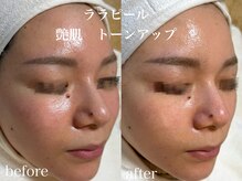 ネオリー(neorii)/ララピール　韓国艶肌