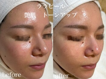 ネオリー(neorii)/ララピール　韓国艶肌