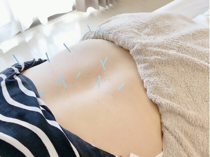 鍼灸サロン 道の写真
