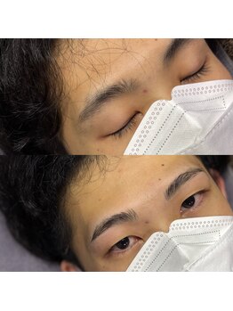 ニューフェイス(NEW FACE)/before/after