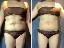 カナウ(kanau)の雰囲気（痩身マシンをフル活用！最新×最速のWアプローチで卒業者続出）