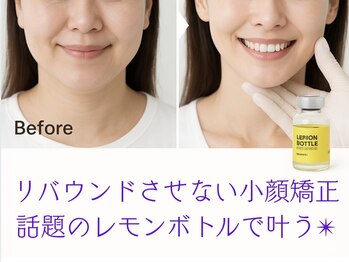 癒真天神の写真/マスク生活でたるんだフェイスラインを改善！“レモンボトル”で脂肪分解！ダウンタイムなしで小顔ケア♪
