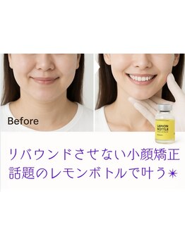 小顔になりたい