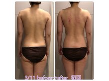 マテリアル 痩身骨気サロン(MATERIAL)