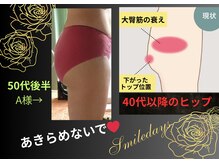 スマイルデイズ(Smiledays)の雰囲気（年内ヒップアップを全面サポートした、嬉しい企画を体験！）