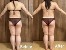 エミア(Emia)/全身痩せ×歪み改善◎120分 