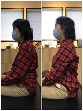 くすの樹接骨院 整体院 鳥栖院/整体/骨盤矯正ビフォーアフター