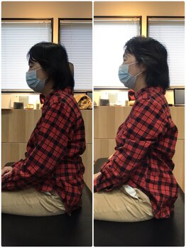 くすの樹接骨院 整体院 鳥栖院/整体/骨盤矯正ビフォーアフター