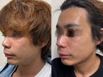 サロン エマ(salon emma)/2回の効果♪男性もおすすめ◎