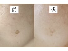 ルビーサロン(ruby-salon)/