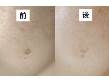 ルビーサロン(ruby-salon)/