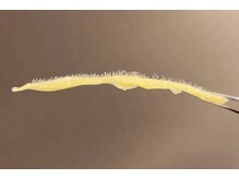 アピュルテ(A purete')/【白玉WAX後の産毛や角質】