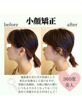 RKY/小顔矯正&頭蓋骨矯正で横顔美人