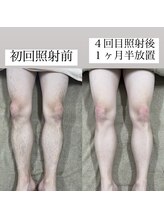 テンパ ビューティー(+10%beauty)/効果写真