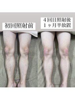 テンパ ビューティー(+10%beauty)/効果写真