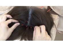 ミヤビ 代々木(MIYABI)/育毛促進美髪鍼