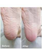 リゼラアンドコー 表参道店/