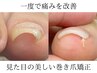 【一度で痛みを改善！】見た目の美しい巻き爪矯正 7,700円～