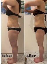 ブレス 天童店(BLESS)/セルゼロ半身5回目