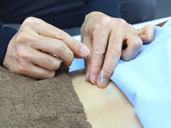 とだ鍼灸院/《鍼灸施術》ぎっくりも対応◎