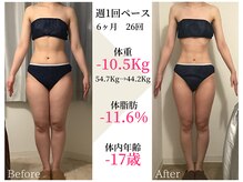 ベルタ 仙台店(BELTA)/【ケア前→後】6ヶ月で-10.5キロ
