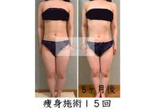 アイ エステサロン(Ai)/【20代】LサイズからSサイズに！