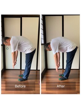 ミントのかべの整体院/施術ビフォーアフター