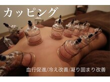 ラースパアザブ 札幌円山(La SPA azabu)/LaSPAazabu-札幌円山-カッピング