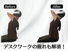 ハリユナイテッド 原宿鍼灸 整体院(HALI UNITED)/デスクワークの疲れも解消！