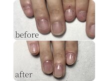 アトリエ クラシック(atelier classic)の雰囲気（自爪育成/巻爪などトラブルネイルメニューもございます。）